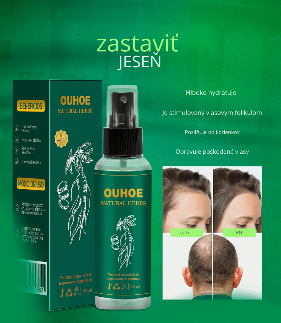 Elhoe rast vlasov -2x1: rast vlasov a kontrola vypadávania vlasov - 100% prírodné